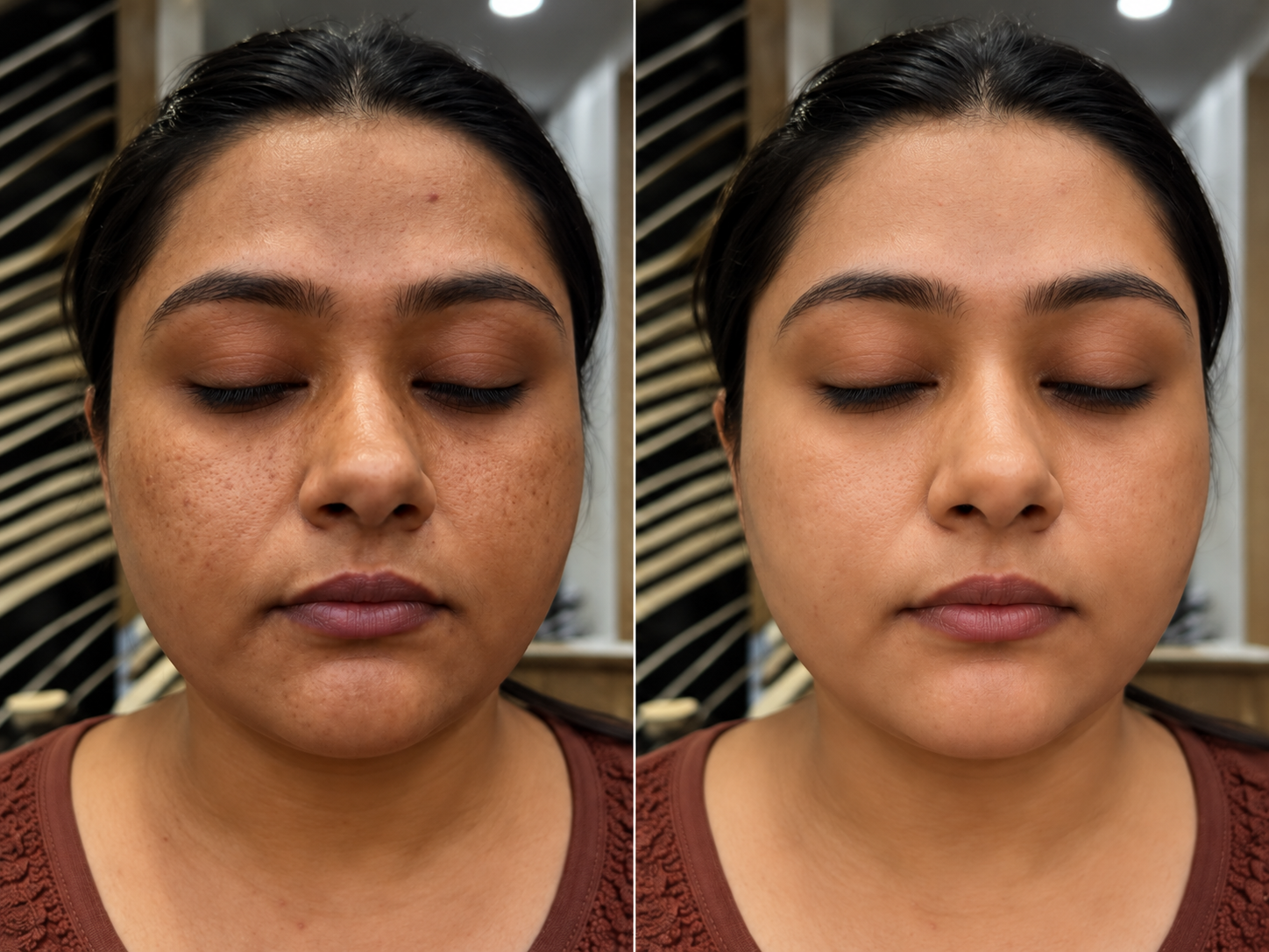 Brightening Treatments