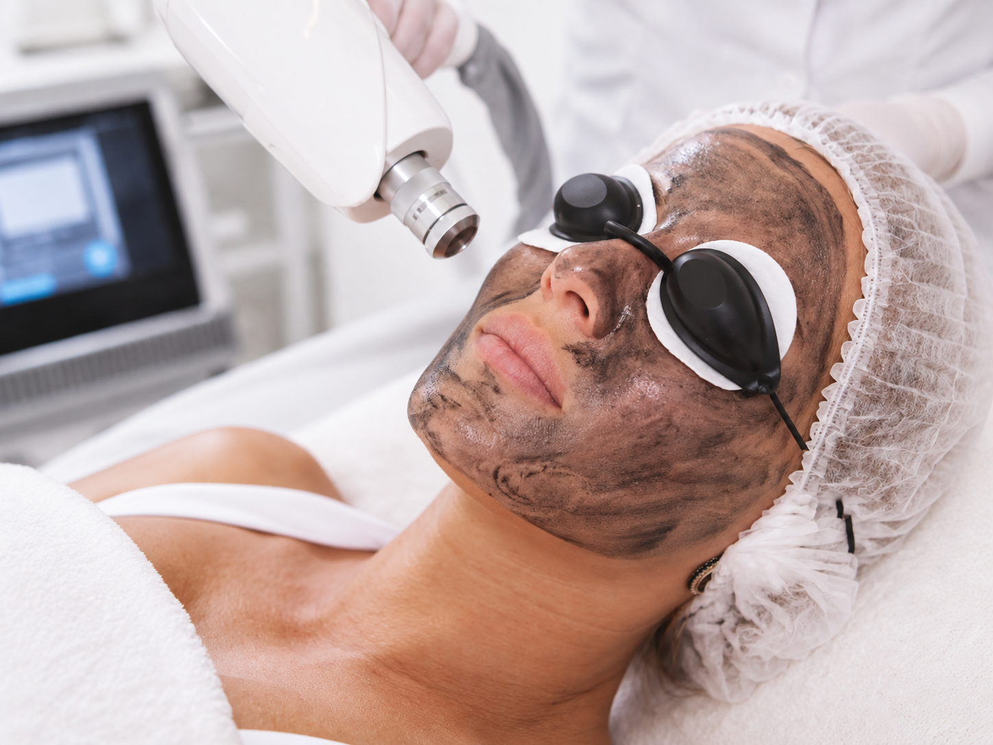 Carbon Facial