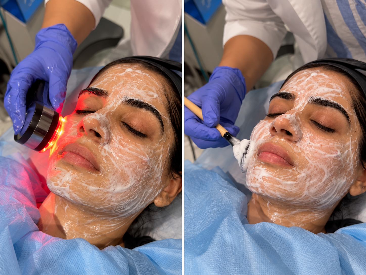 Foaming & Enzyme Facial